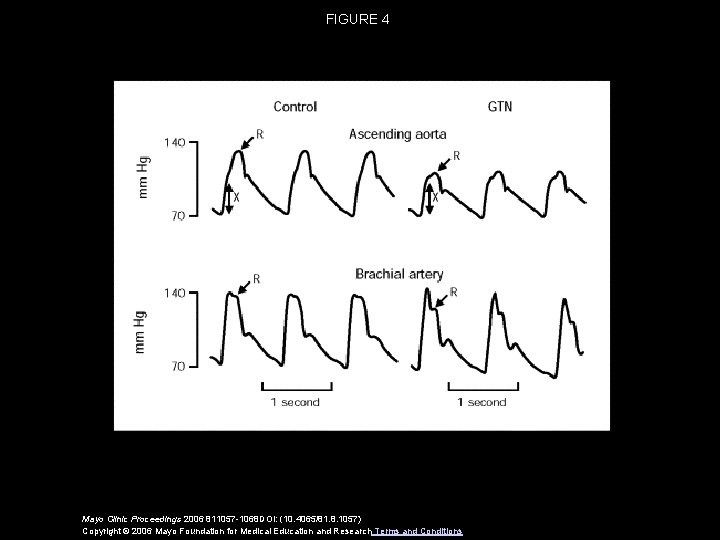 FIGURE 4 Mayo Clinic Proceedings 2006 811057 -1068 DOI: (10. 4065/81. 8. 1057) Copyright