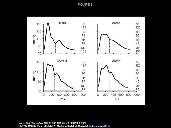 FIGURE 6 Mayo Clinic Proceedings 2006 811057 -1068 DOI: (10. 4065/81. 8. 1057) Copyright