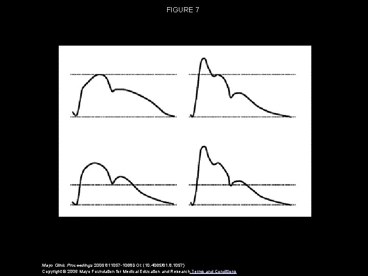 FIGURE 7 Mayo Clinic Proceedings 2006 811057 -1068 DOI: (10. 4065/81. 8. 1057) Copyright