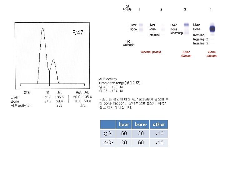 F/47 liver bone other 성인 60 30 <10 소아 30 60 <10 