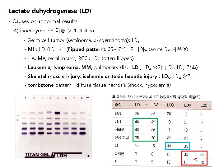 Lactate dehydrogenase (LD) - Causes of abnormal results 4) isoenzyme EP 이용 (2 -1