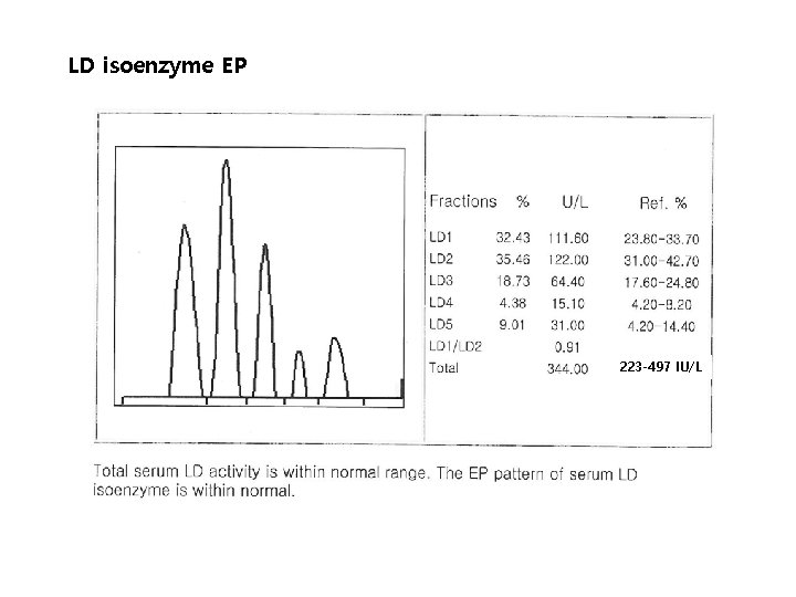LD isoenzyme EP 223 -497 IU/L 