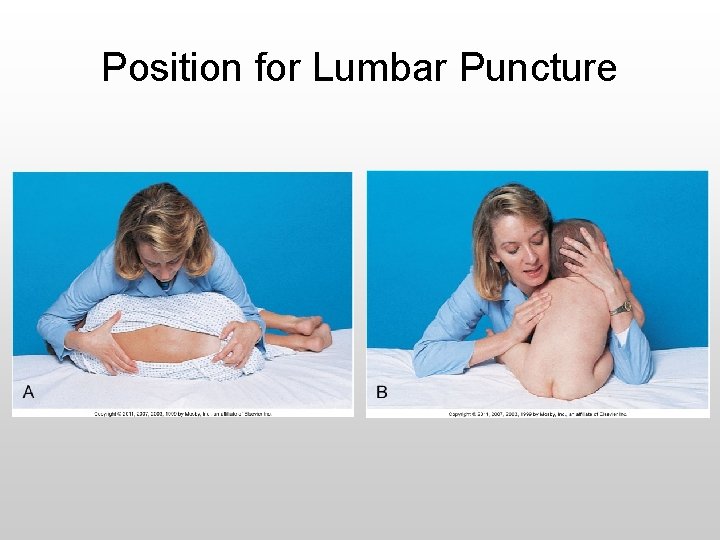 Position for Lumbar Puncture 