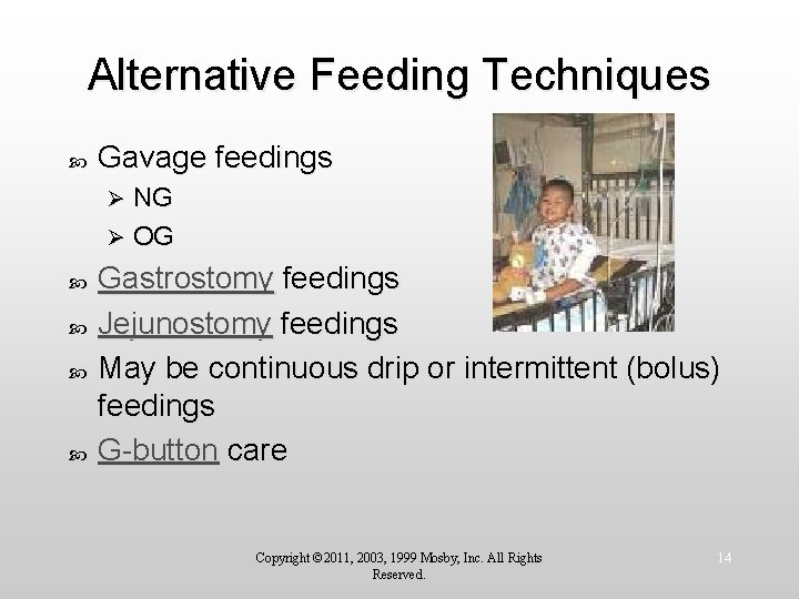 Alternative Feeding Techniques Gavage feedings NG Ø OG Ø Gastrostomy feedings Jejunostomy feedings May