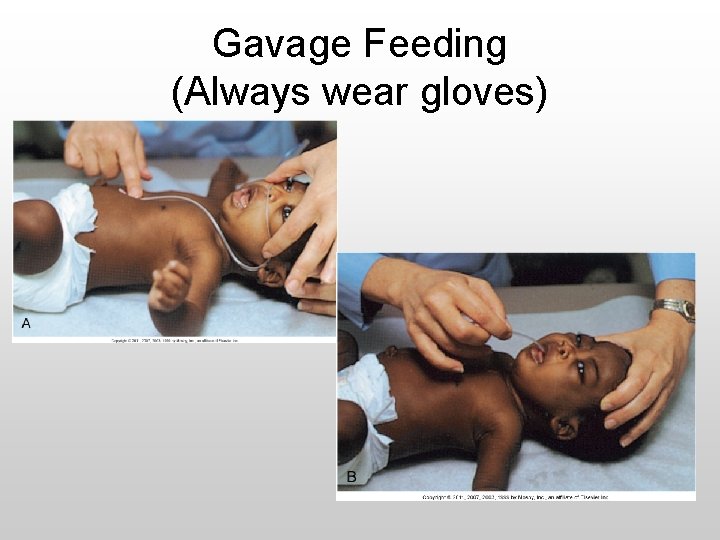 Gavage Feeding (Always wear gloves) 