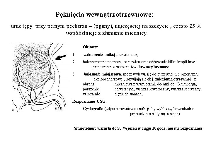 Pęknięcia wewnątrzotrzewnowe: uraz tępy przy pełnym pęcherzu – (pijany), najczęściej na szczycie , często