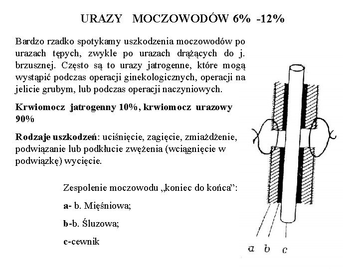 URAZY MOCZOWODÓW 6% -12% Bardzo rzadko spotykamy uszkodzenia moczowodów po urazach tępych, zwykle po