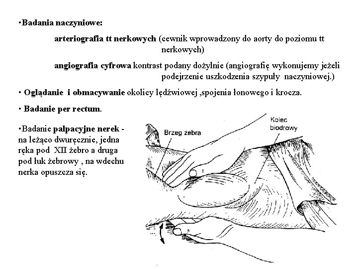  • Badania naczyniowe: arteriografia tt nerkowych (cewnik wprowadzony do aorty do poziomu tt