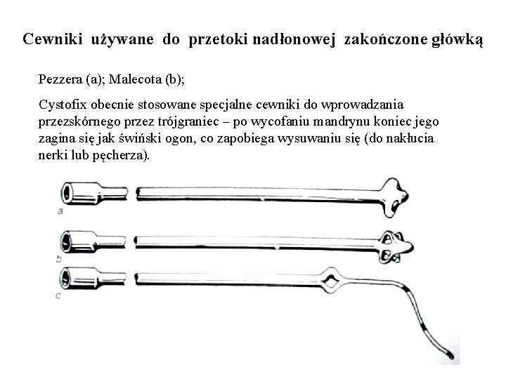 Cewniki używane do przetoki nadłonowej zakończone główką Pezzera (a); Malecota (b); Cystofix obecnie stosowane