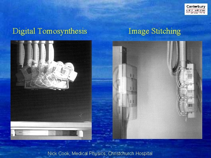 Digital Tomosynthesis Image Stitching Nick Cook, Medical Physics, Christchurch Hospital 