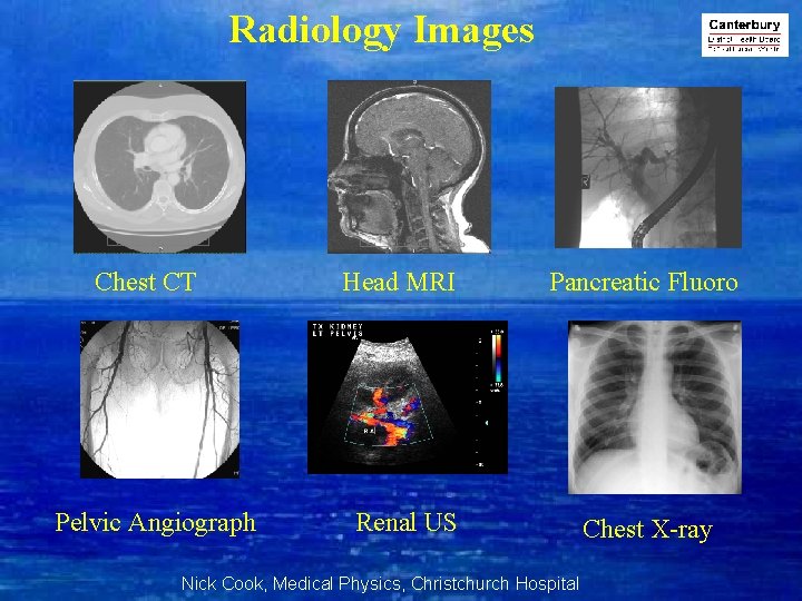 Radiology Images Chest CT Pelvic Angiograph Head MRI Pancreatic Fluoro Renal US Nick Cook,