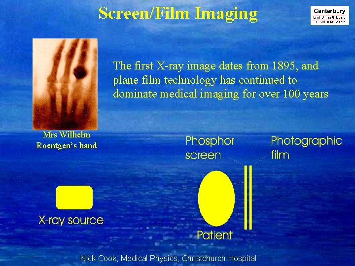 Screen/Film Imaging The first X-ray image dates from 1895, and plane film technology has