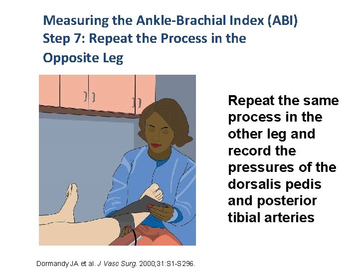 Measuring the Ankle-Brachial Index (ABI) Step 7: Repeat the Process in the Opposite Leg