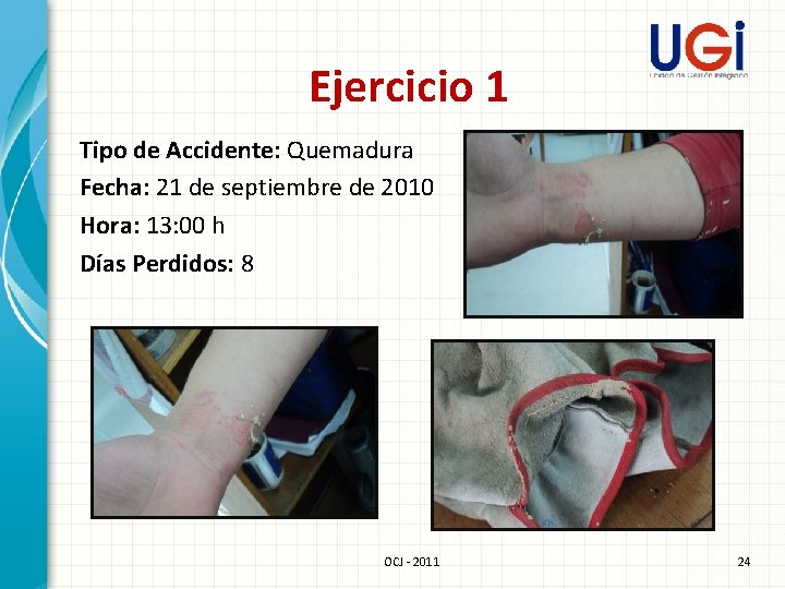 Ejercicio 1 Tipo de Accidente: Quemadura Fecha: 21 de septiembre de 2010 Hora: 13: