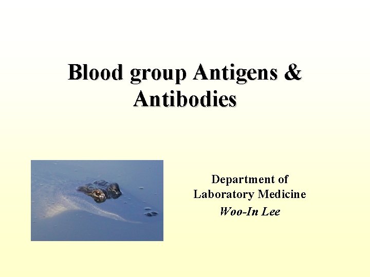Blood group Antigens & Antibodies Department of Laboratory Medicine Woo-In Lee 