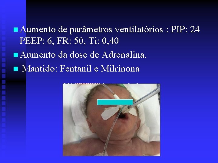 n Aumento de parâmetros ventilatórios : PIP: 24 PEEP: 6, FR: 50, Ti: 0,