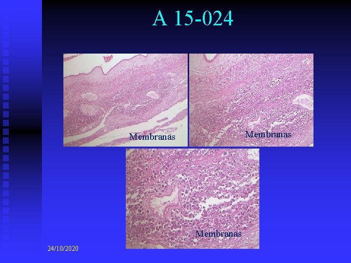 A 15 -024 Membranas 24/10/2020 