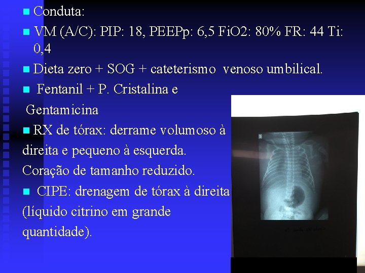 n Conduta: n VM (A/C): PIP: 18, PEEPp: 6, 5 Fi. O 2: 80%