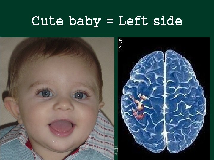 Cute baby = Left side Cute baby = Left side