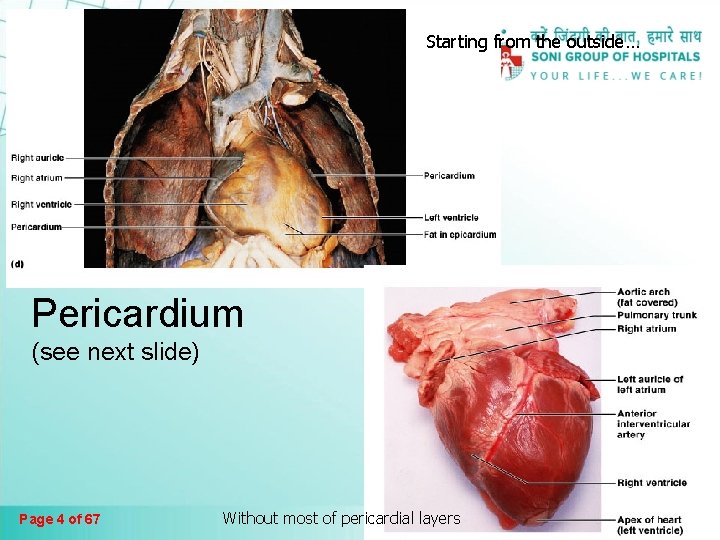 Starting from the outside… Pericardium (see next slide) Page 4 of 67 Without most Starting from the outside… Pericardium (see next slide) Page 4 of 67 Without most
