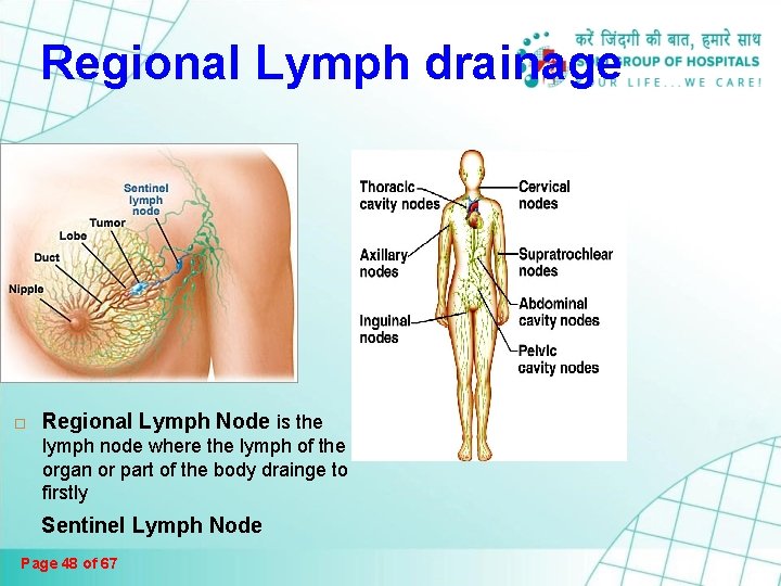 Regional Lymph drainage Regional Lymph Node is the lymph node where the lymph of Regional Lymph drainage Regional Lymph Node is the lymph node where the lymph of