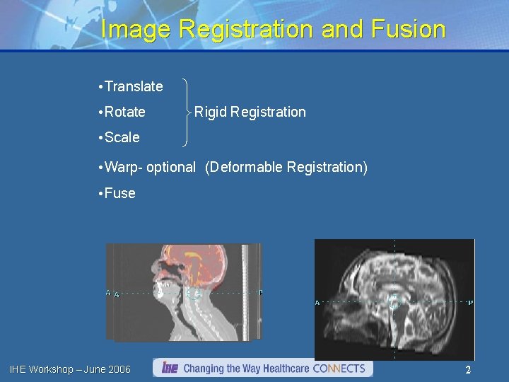 Image Registration and Fusion • Translate • Rotate Rigid Registration • Scale • Warp-