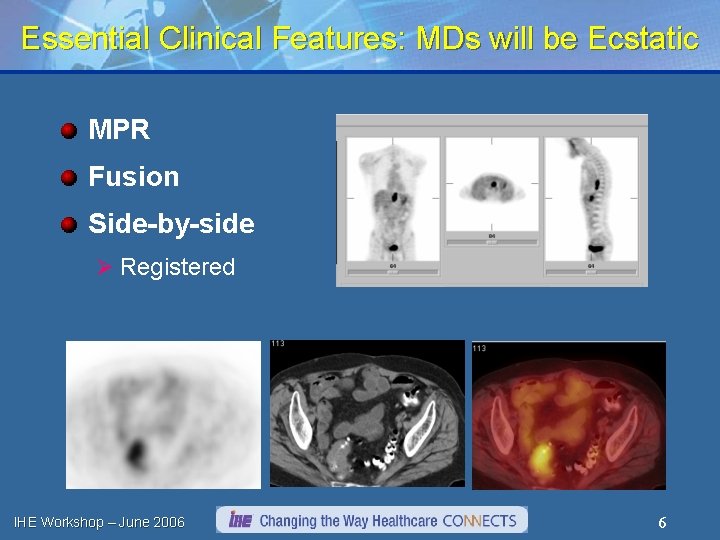 Essential Clinical Features: MDs will be Ecstatic MPR Fusion Side-by-side Ø Registered IHE Workshop