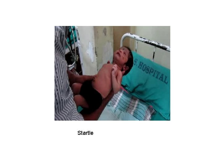 Startle 