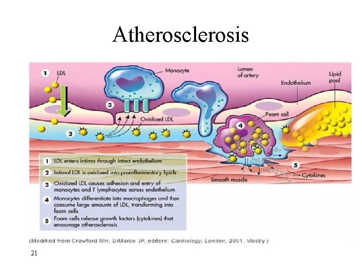 Atherosclerosis 21 