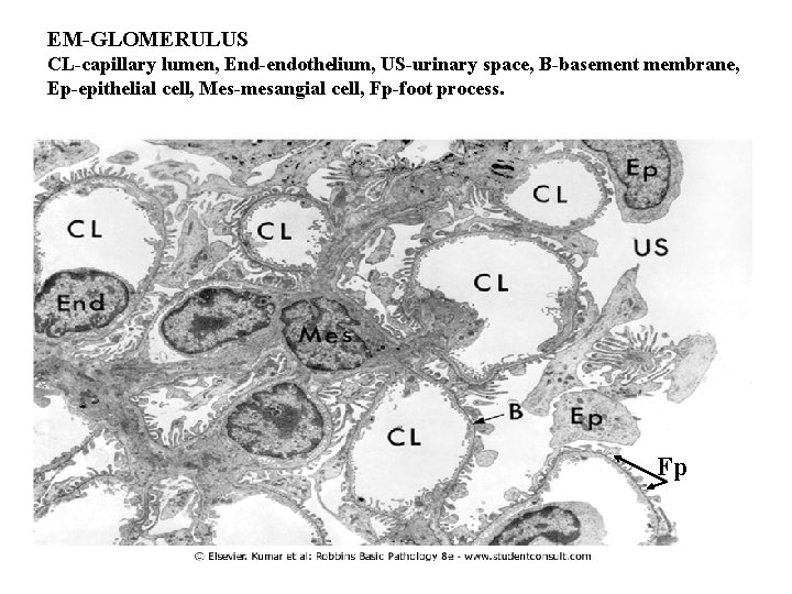 EM-GLOMERULUS CL-capillary lumen, End-endothelium, US-urinary space, B-basement membrane, Ep-epithelial cell, Mes-mesangial cell, Fp-foot process.