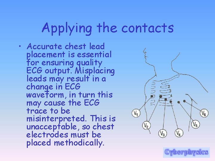 Applying the contacts • Accurate chest lead placement is essential for ensuring quality ECG
