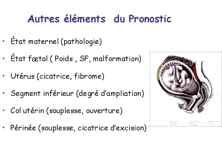 Autres éléments du Pronostic • État maternel (pathologie) • État fœtal ( Poids ,