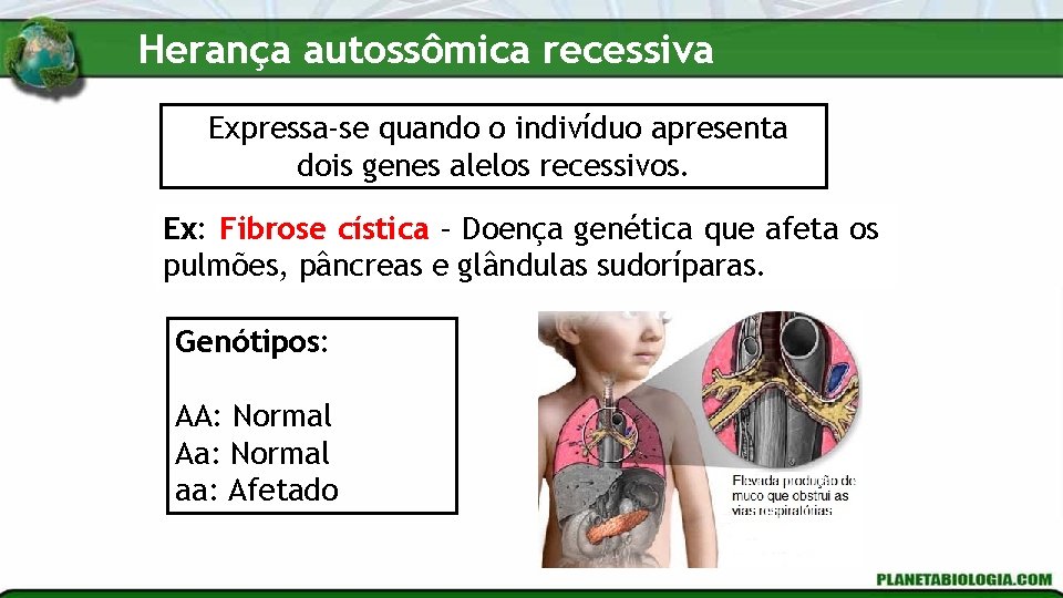 Herança autossômica recessiva Expressa-se quando o indivíduo apresenta dois genes alelos recessivos. Ex: Fibrose