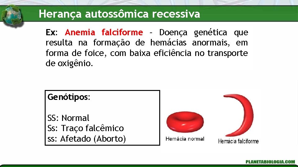 Herança autossômica recessiva Ex: Anemia falciforme – Doença genética que resulta na formação de