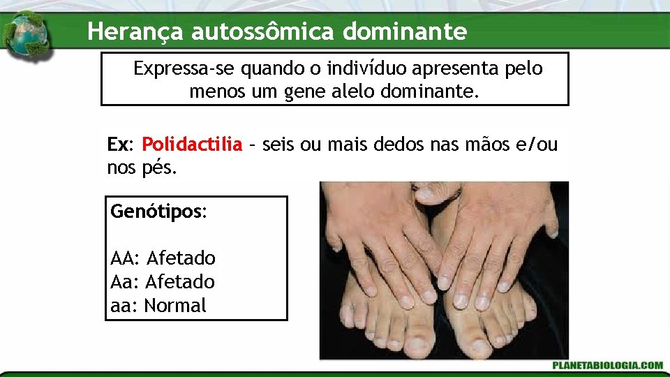 Herança autossômica dominante Expressa-se quando o indivíduo apresenta pelo menos um gene alelo dominante. Herança autossômica dominante Expressa-se quando o indivíduo apresenta pelo menos um gene alelo dominante.