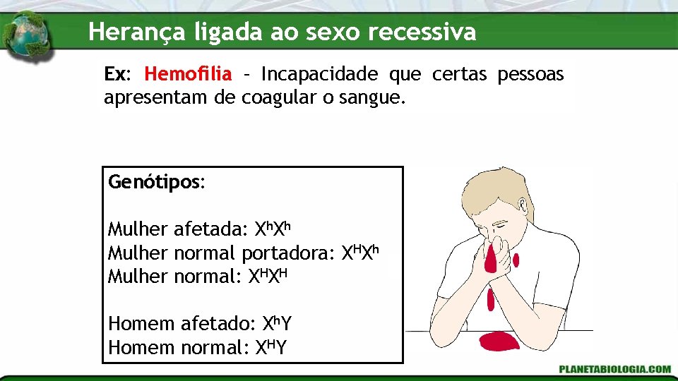 Herança ligada ao sexo recessiva Ex: Hemofilia – Incapacidade que certas pessoas apresentam de