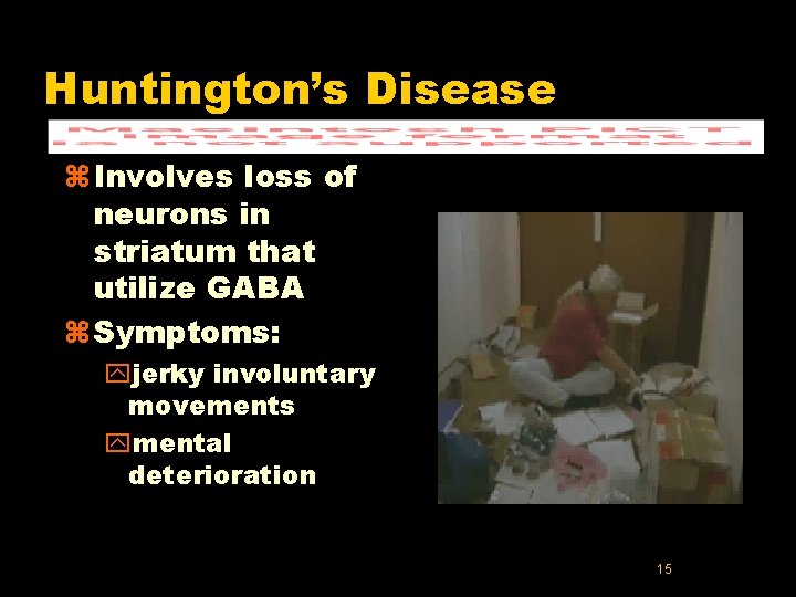 Huntington’s Disease z Involves loss of neurons in striatum that utilize GABA z Symptoms: