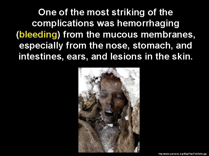 One of the most striking of the complications was hemorrhaging (bleeding) from the mucous