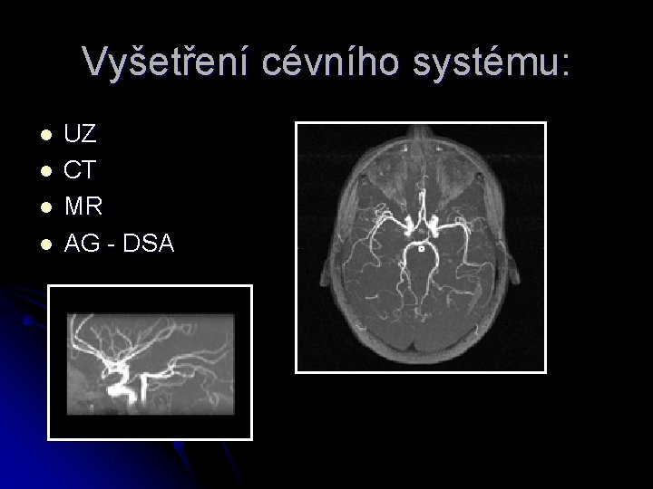 Vyšetření cévního systému: l l UZ CT MR AG - DSA 