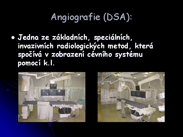 Angiografie (DSA): l Jedna ze základních, speciálních, invazivních radiologických metod, která spočívá v zobrazení