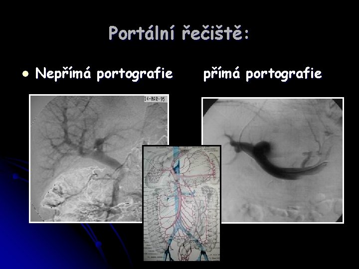 Portální řečiště: l Nepřímá portografie 