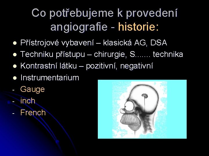 Co potřebujeme k provedení angiografie - historie: l l - Přístrojové vybavení – klasická