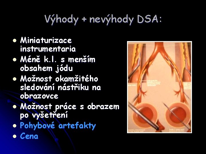 Výhody + nevýhody DSA: l l l Miniaturizace instrumentaria Méně k. l. s menším