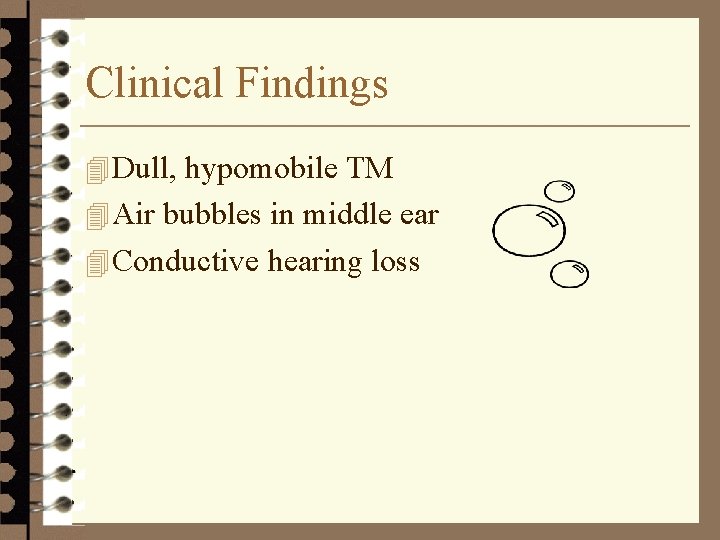 Clinical Findings 4 Dull, hypomobile TM 4 Air bubbles in middle ear 4 Conductive