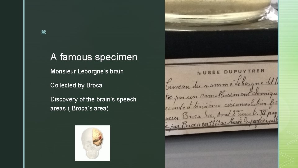 z A famous specimen Monsieur Leborgne’s brain Collected by Broca Discovery of the brain’s