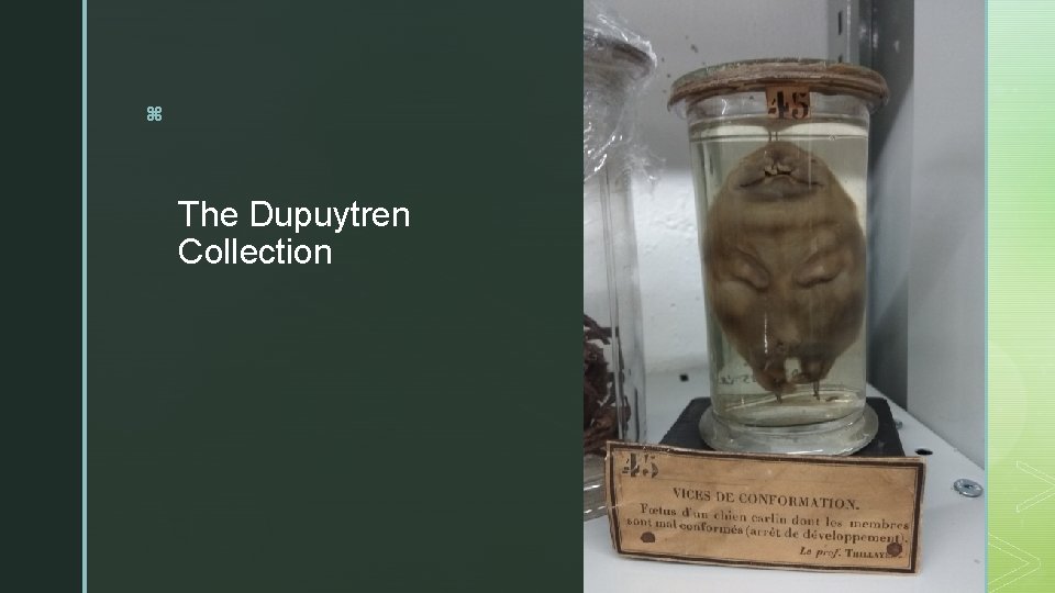 z The Dupuytren Collection 