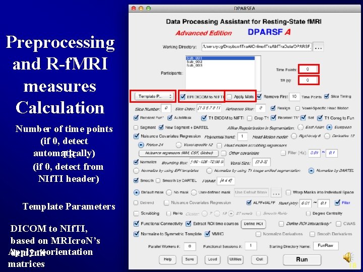 Preprocessing and R-f. MRI measures Calculation Number of time points (if 0, detect automatically)