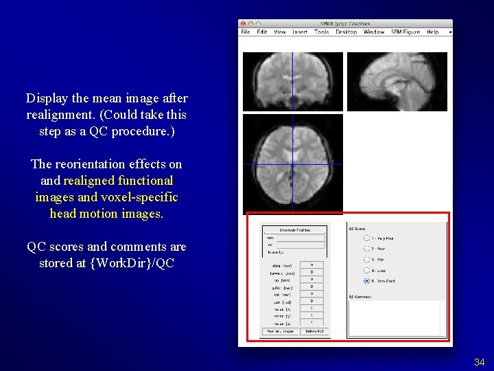 Display the mean image after realignment. (Could take this step as a QC procedure.