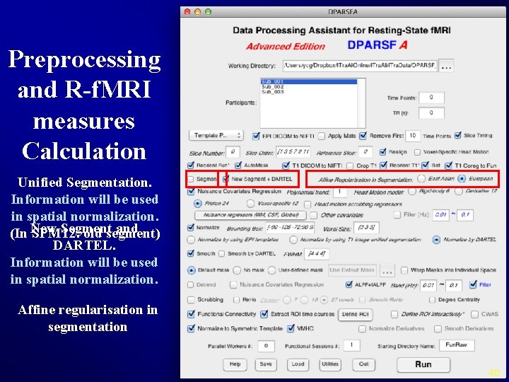 Preprocessing and R-f. MRI measures Calculation Unified Segmentation. Information will be used in spatial