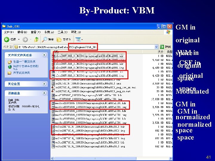 By-Product: VBM GM in original WM in space CSF in original space Modulated GM